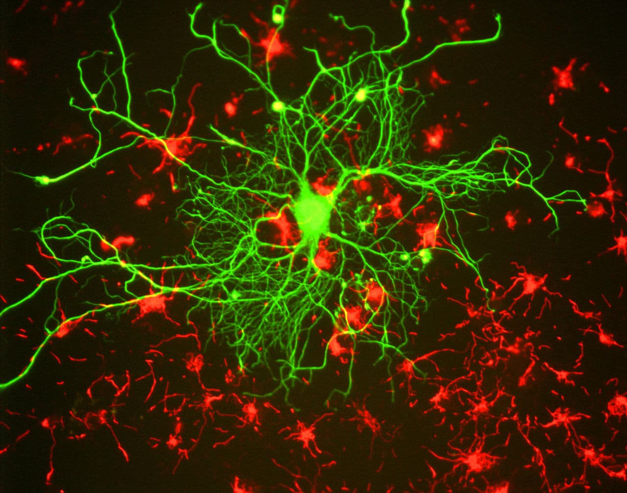 Knowing Neurons