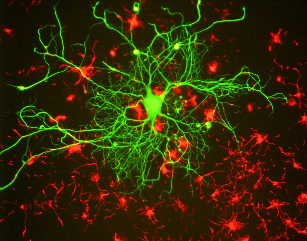 Knowing Neurons